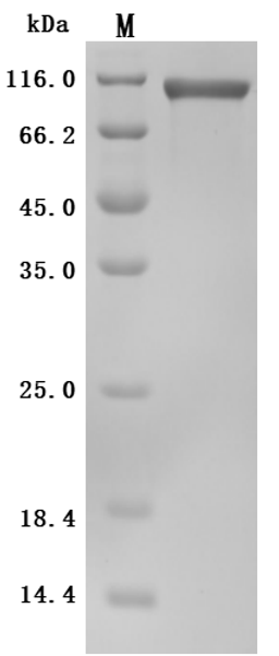 (Tris-Glycine gel) Discontinuous SDS-PAGE (reduced) with 5% enrichment gel and 15% separation gel.