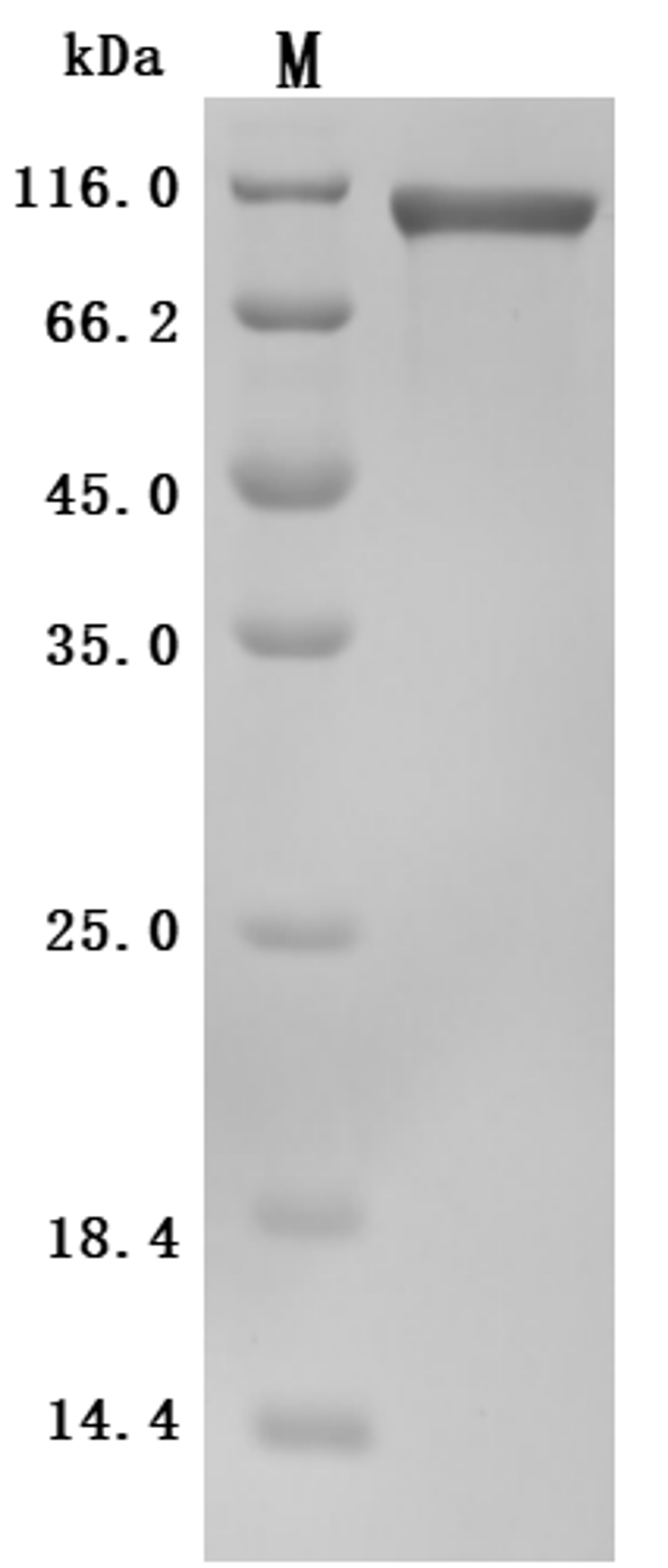 (Tris-Glycine gel) Discontinuous SDS-PAGE (reduced) with 5% enrichment gel and 15% separation gel.