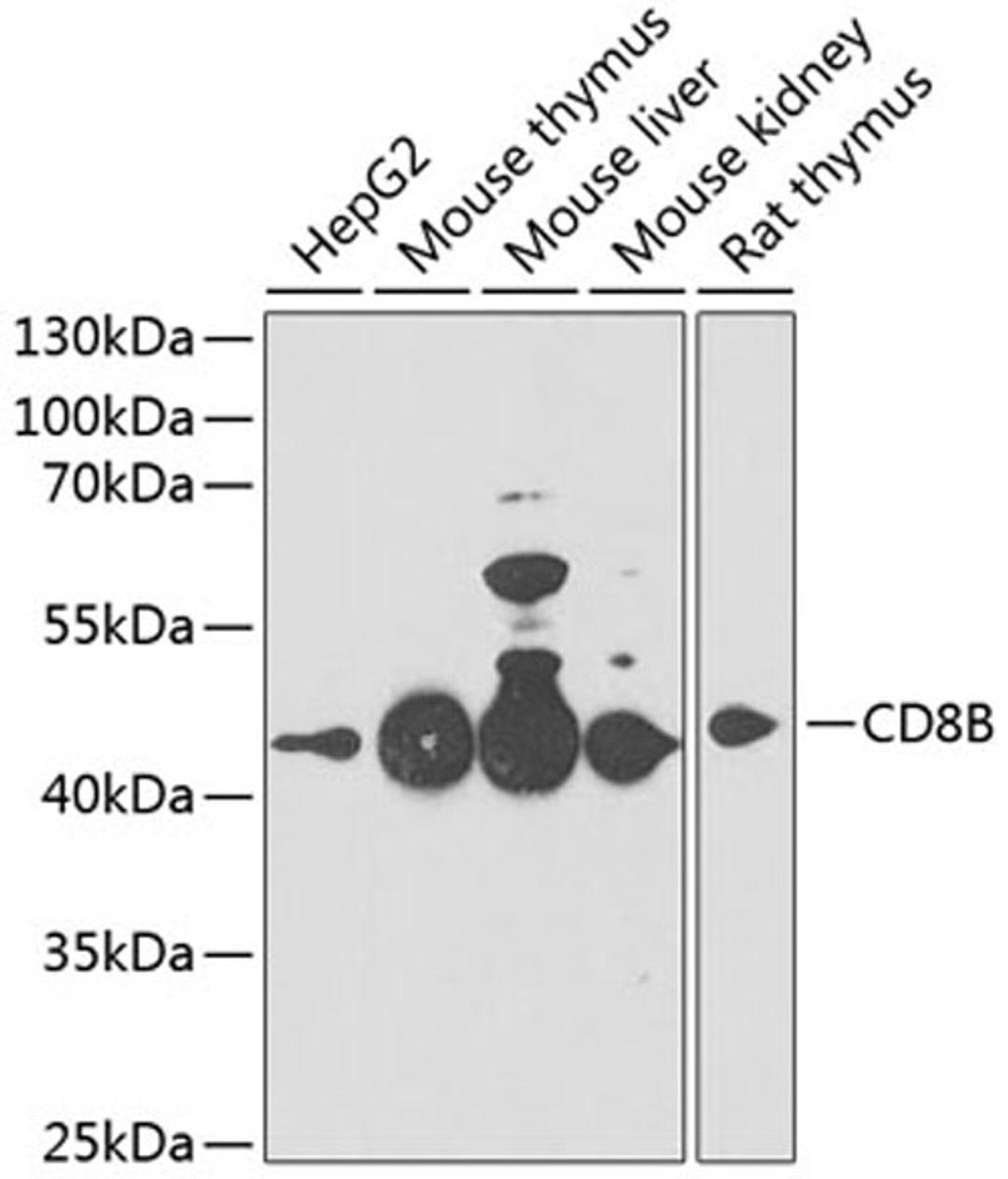 Western blot - CD8B antibody (A3286)