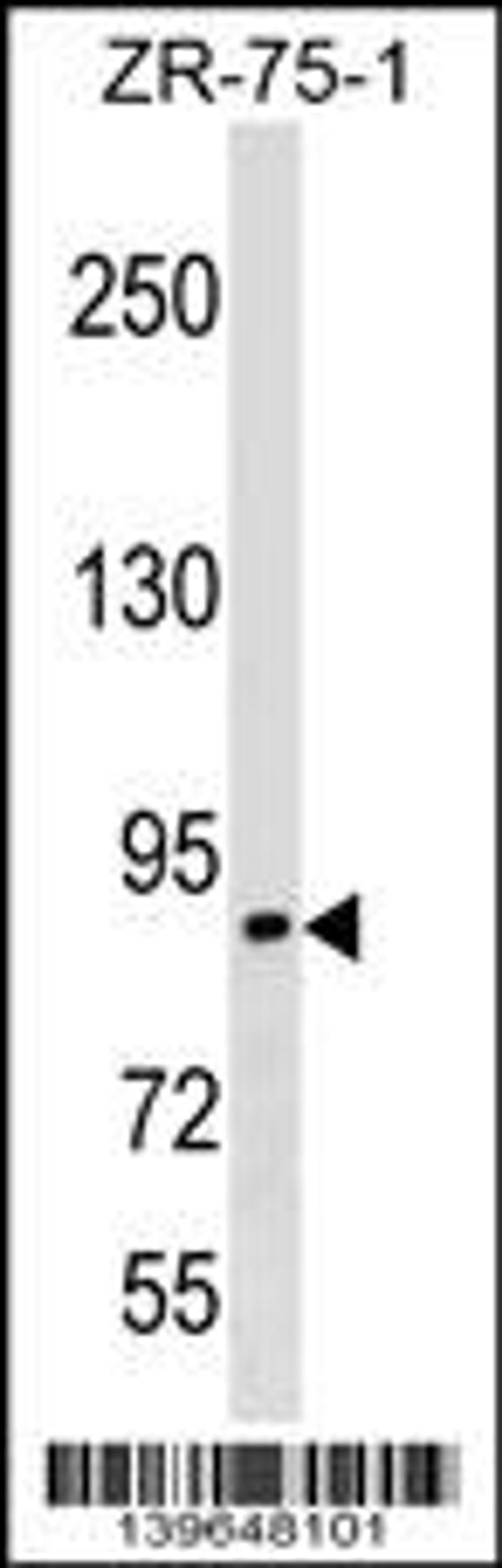 Western blot analysis in ZR-75-1 cell line lysates (35ug/lane).