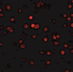 Immunofluorescence: RIMS3 Antibody [NBP1-76874] - Human brain tissue with RIMS3 antibody at 5 ug/mL.