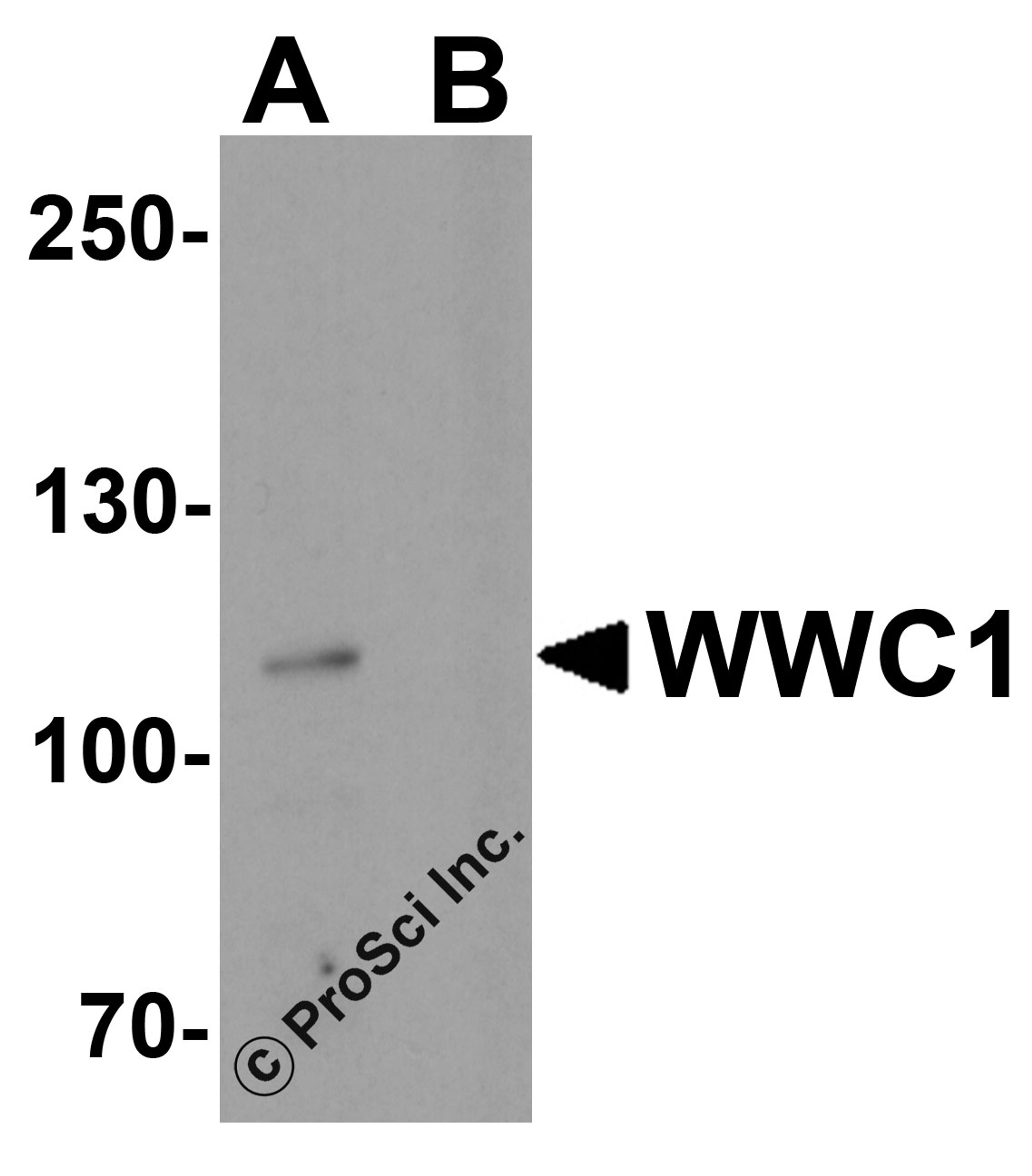 Western blot analysis of WWC1 in human brain tissue lysate with WWC1 antibody at 1 μg/ml in (A) the absence and (B) the presence of blocking peptide.