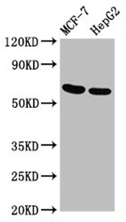 Western Blot. Positive WB detected in: MCF-7 whole cell lysate, HepG2 whole cell lysate. All lanes: GNAS antibody at 3.4µg/ml. Secondary. Goat polyclonal to rabbit IgG at 1/50000 dilution. Predicted band size: 68 kDa. Observed band size: 68 kDa