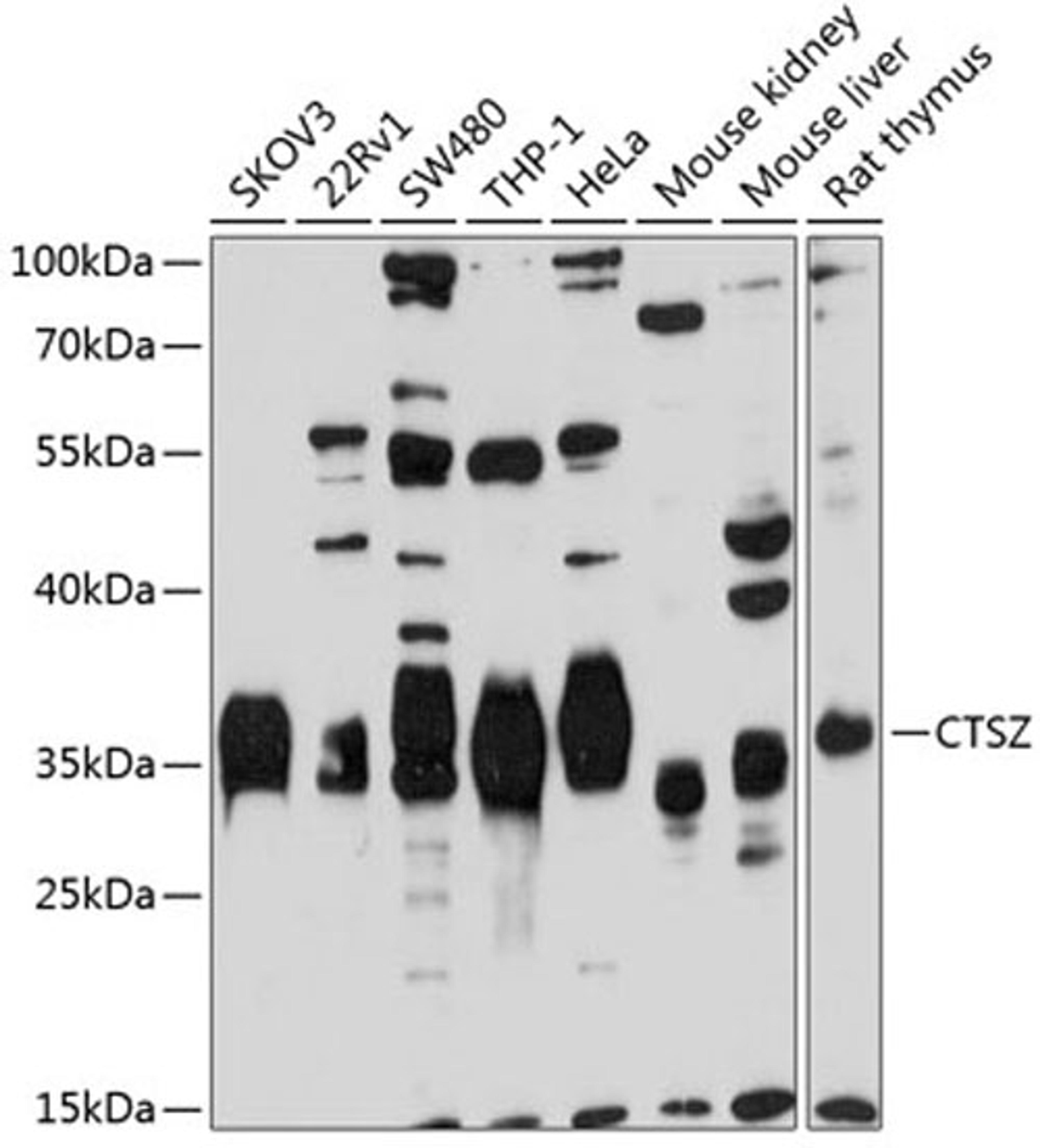 Western blot - CTSZ antibody (A2681)