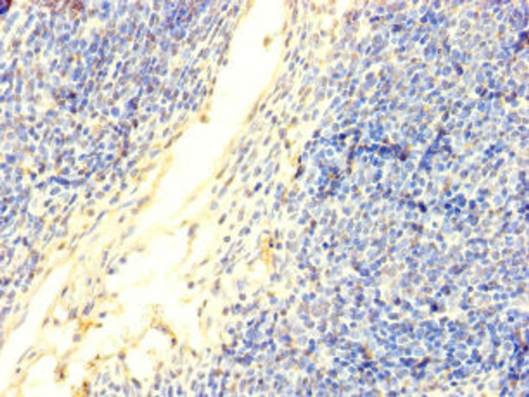 Immunohistochemistry of paraffin-embedded human thymus tissue using CSB-PA007088LA01HU at dilution of 1:100