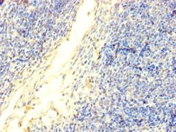 Immunohistochemistry of paraffin-embedded human thymus tissue using CSB-PA007088LA01HU at dilution of 1:100