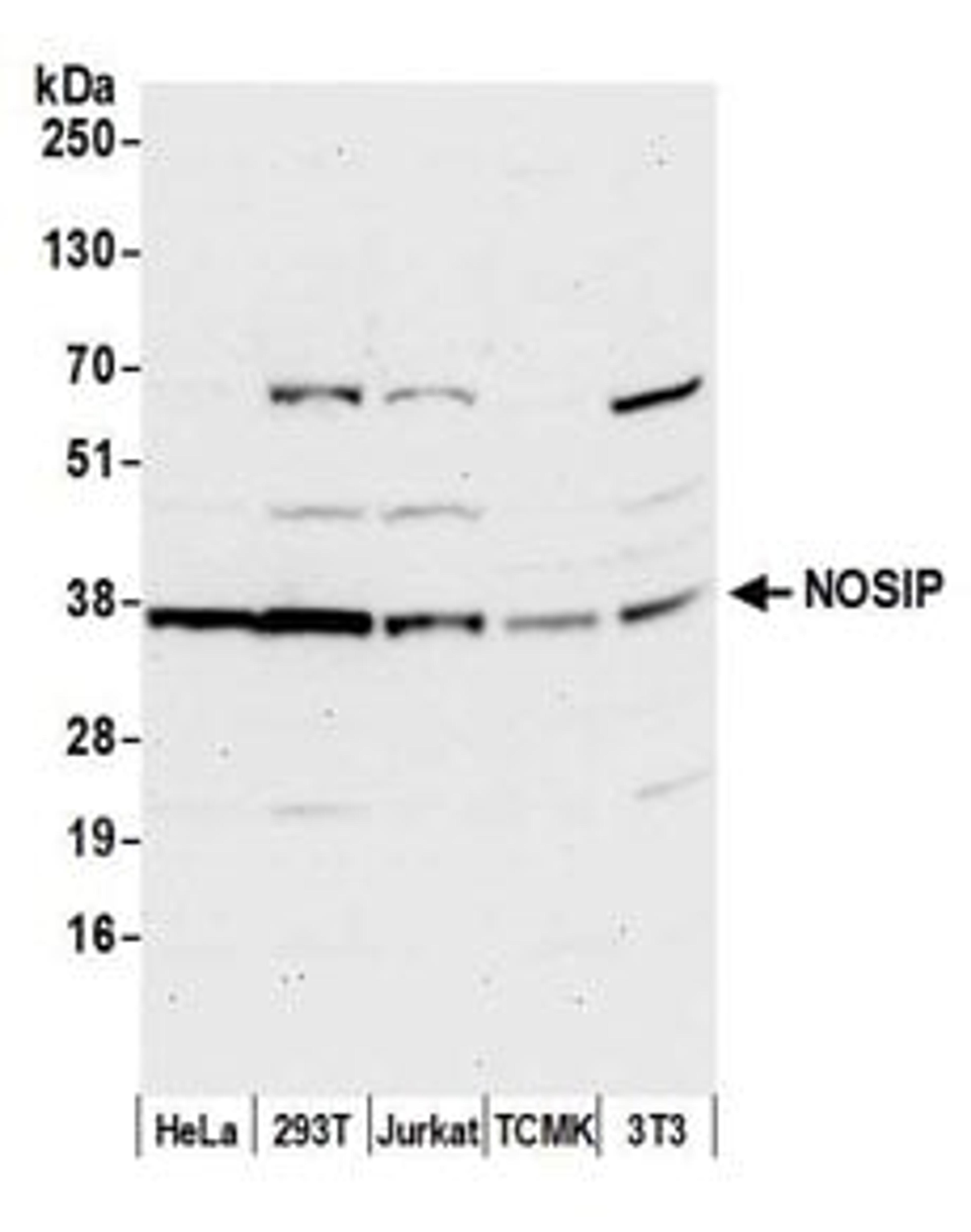 Detection of human and mouse NOSIP by western blot.