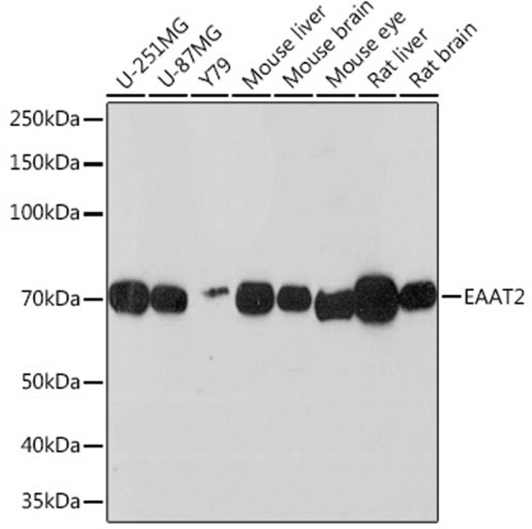 Western blot - EAAT2 Rabbit mAb (A3679)