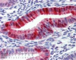 Immunohistochemistry-Paraffin: metallothionein Antibody (UC1MT) [NBP1-97493] - Human uterus tissue stained with Metallothionein, mAb (UC1MT) at 10ug/ml.