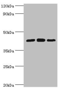 Western blot. All lanes: Nucleolysin TIA-1 isoform p40 antibody at 2ug/ml. Lane 1: Jurkat whole cell lysate. Lane 2: K562 whole cell lysate. Lane 3: Hela whole cell lysate. Secondary. Goat polyclonal to rabbit IgG at 1/10000 dilution. Predicted band size: 43, 42, 25 kDa. Observed band size: 43 kDa.