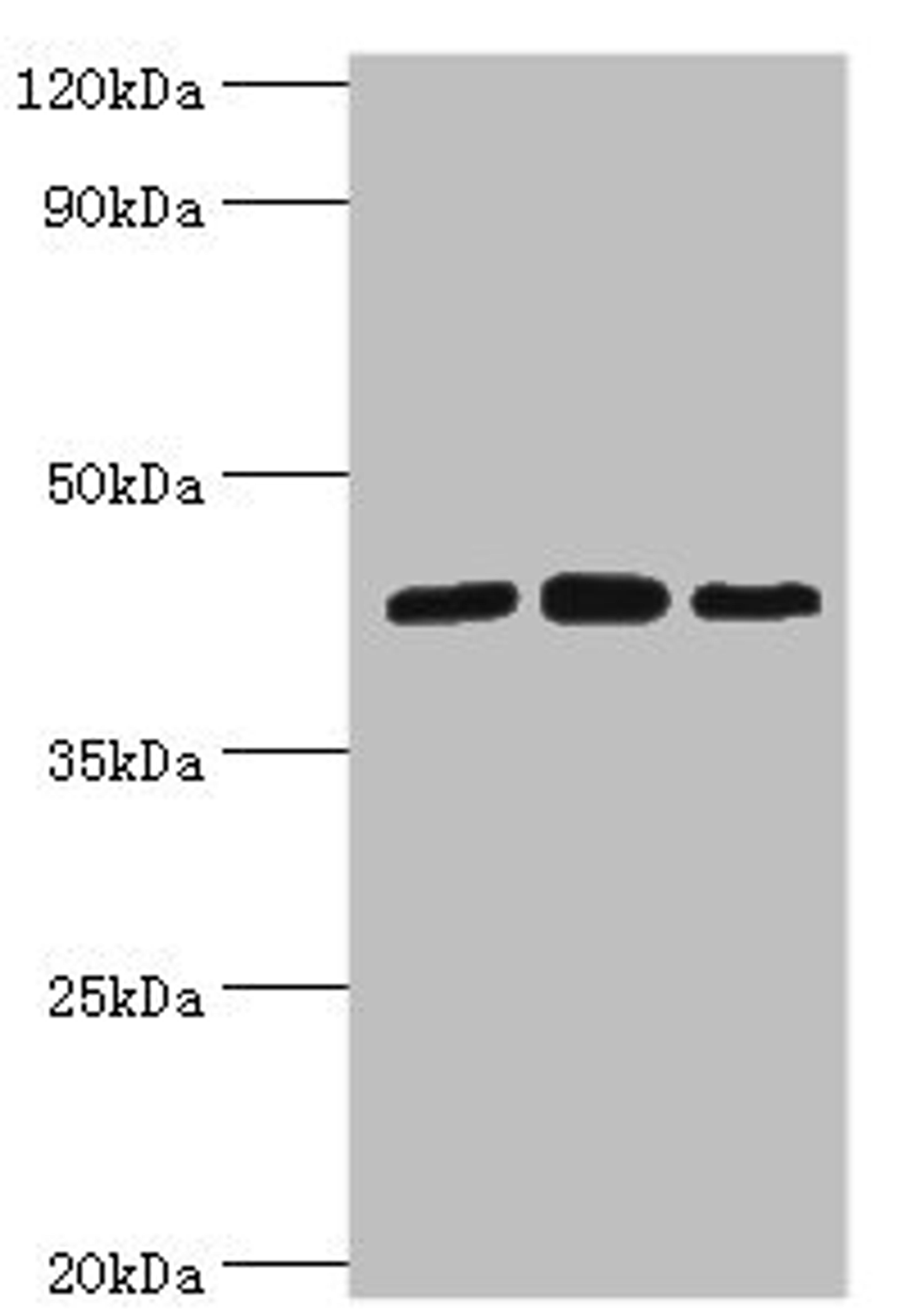 Western blot. All lanes: Nucleolysin TIA-1 isoform p40 antibody at 2ug/ml. Lane 1: Jurkat whole cell lysate. Lane 2: K562 whole cell lysate. Lane 3: Hela whole cell lysate. Secondary. Goat polyclonal to rabbit IgG at 1/10000 dilution. Predicted band size: 43, 42, 25 kDa. Observed band size: 43 kDa.