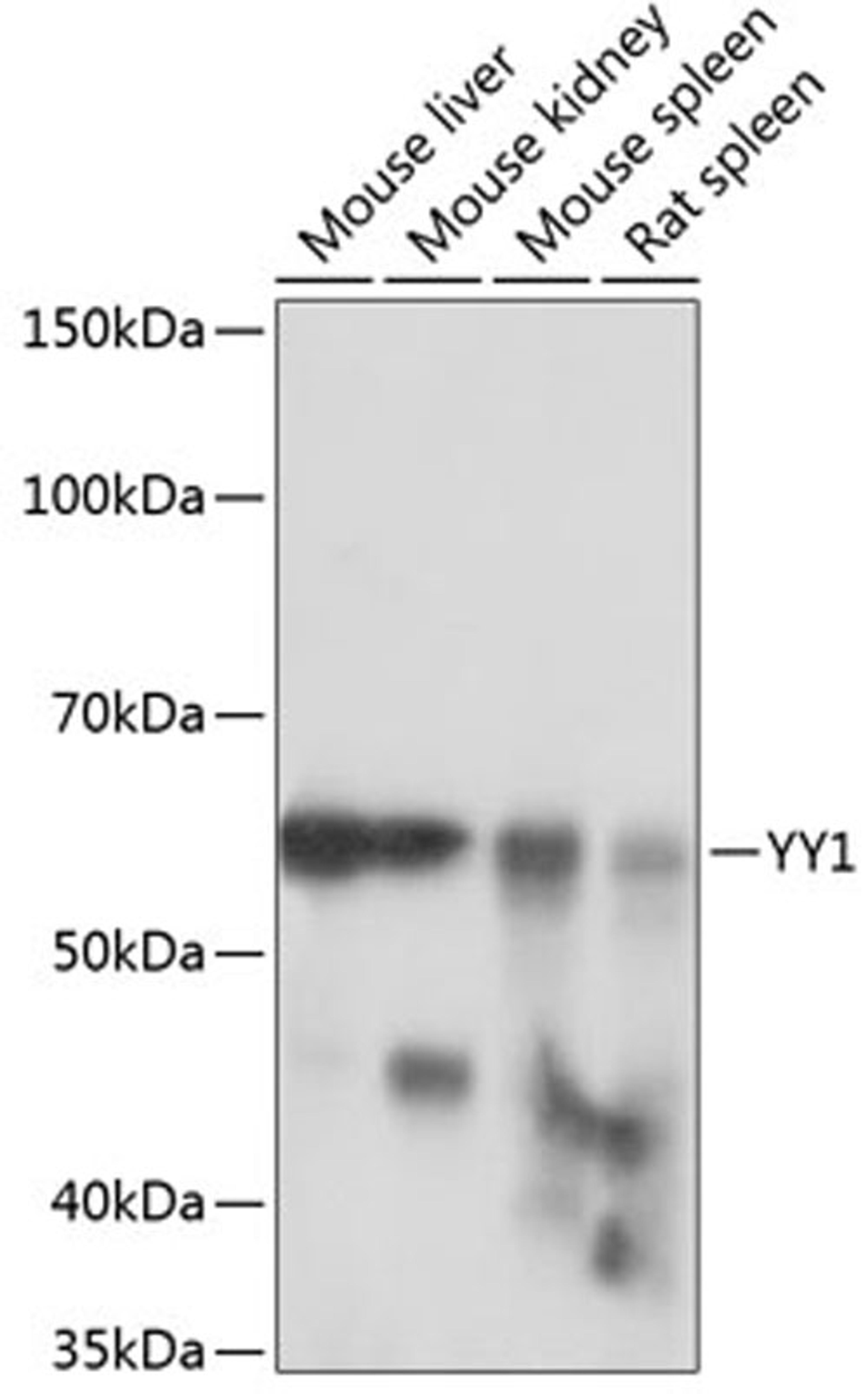 Western blot - YY1 antibody (A19569)