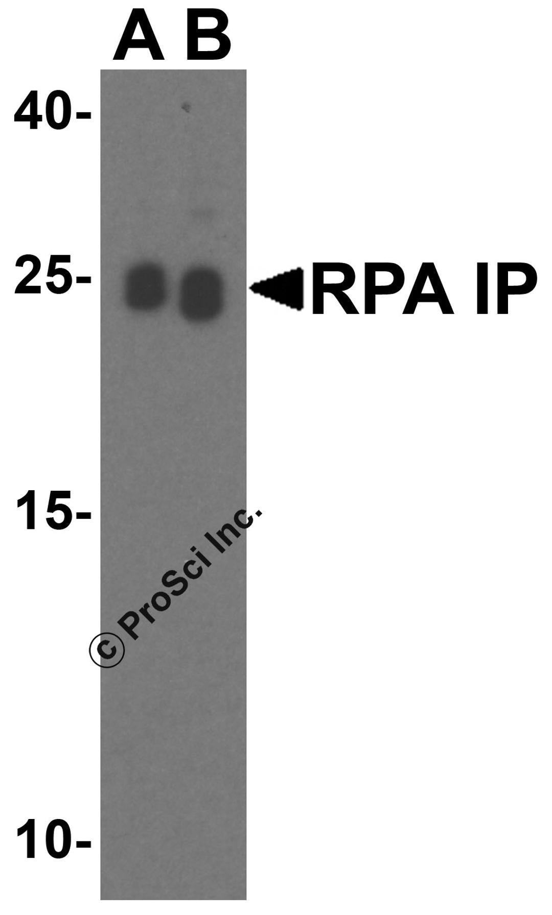 Western blot analysis of RPA Interacting Protein in Jurkat cell lysate with RPA Interacting Protein antibody at (A) 0.5 and (B) 1 μg/mL.