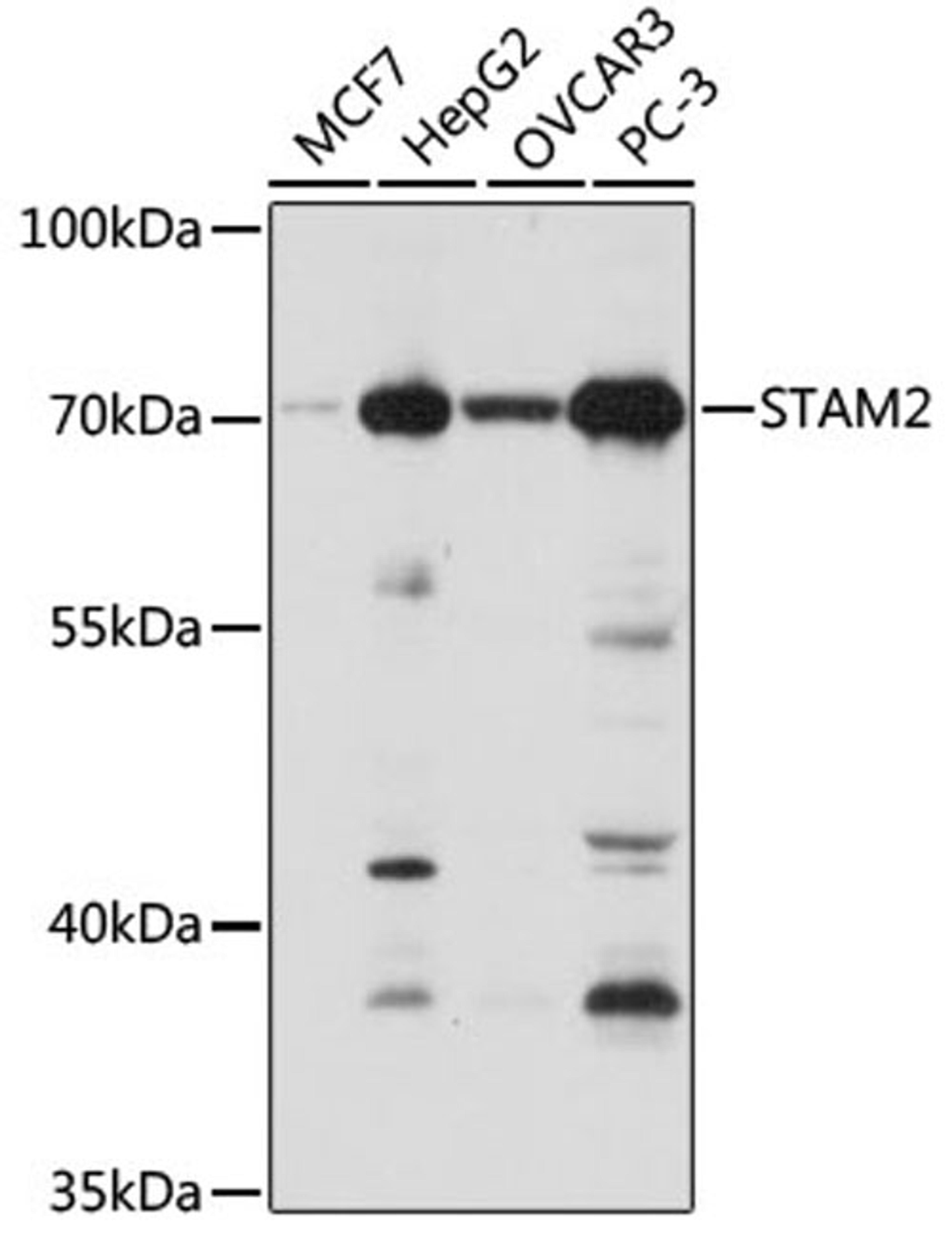 Western blot - STAM2 antibody (A7058)