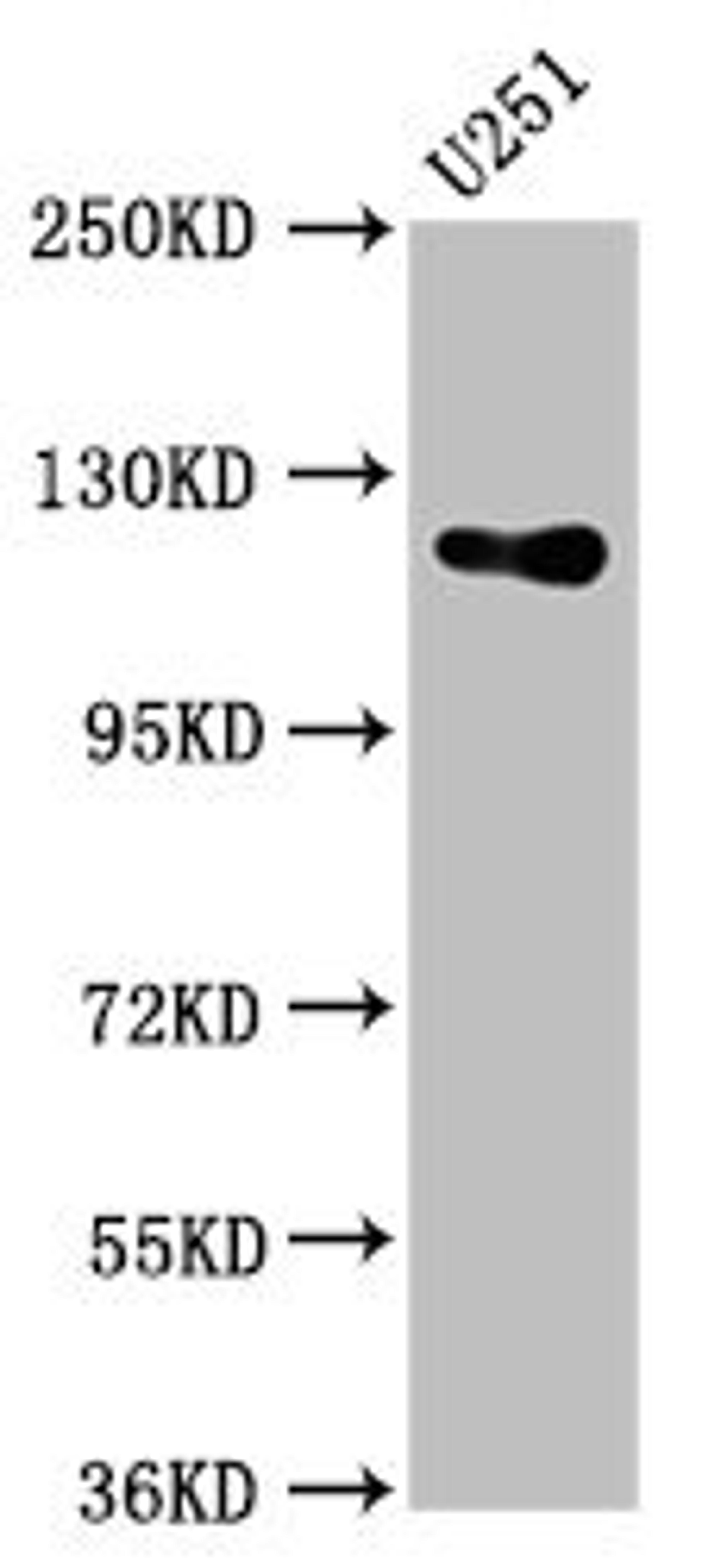 Western Blot. Positive WB detected in: U251 whole cell lysate. All lanes: GUCY2D antibody at 5.4µg/ml. Secondary. Goat polyclonal to rabbit IgG at 1/50000 dilution. Predicted band size: 121 kDa. Observed band size: 121 kDa