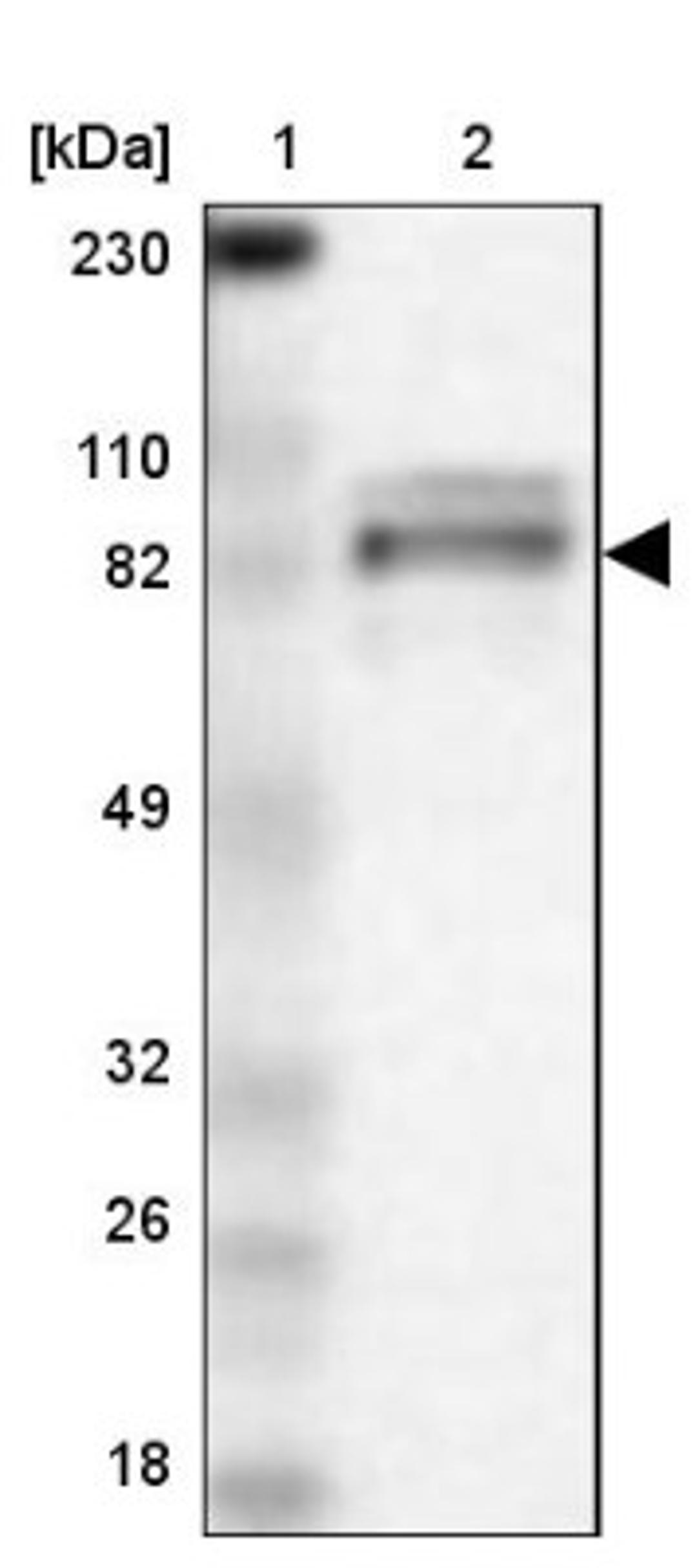 Western Blot: ARHGEF6 Antibody [NBP1-89124] - Lane 1: Marker [kDa] 230, 110, 82, 49, 32, 26, 18<br/>Lane 2: Human cell line RT-4