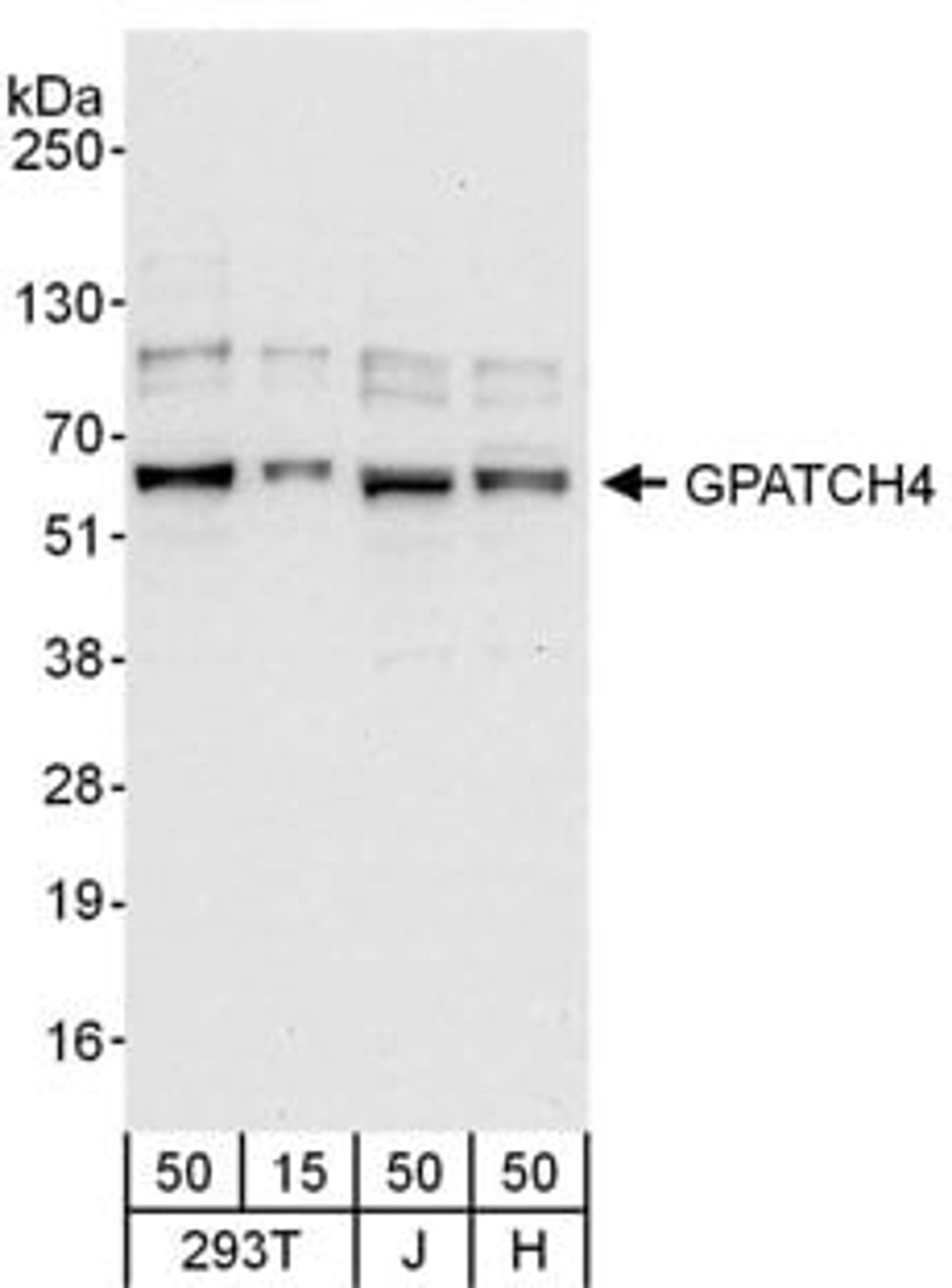 Detection of human GPATCH4 by western blot.