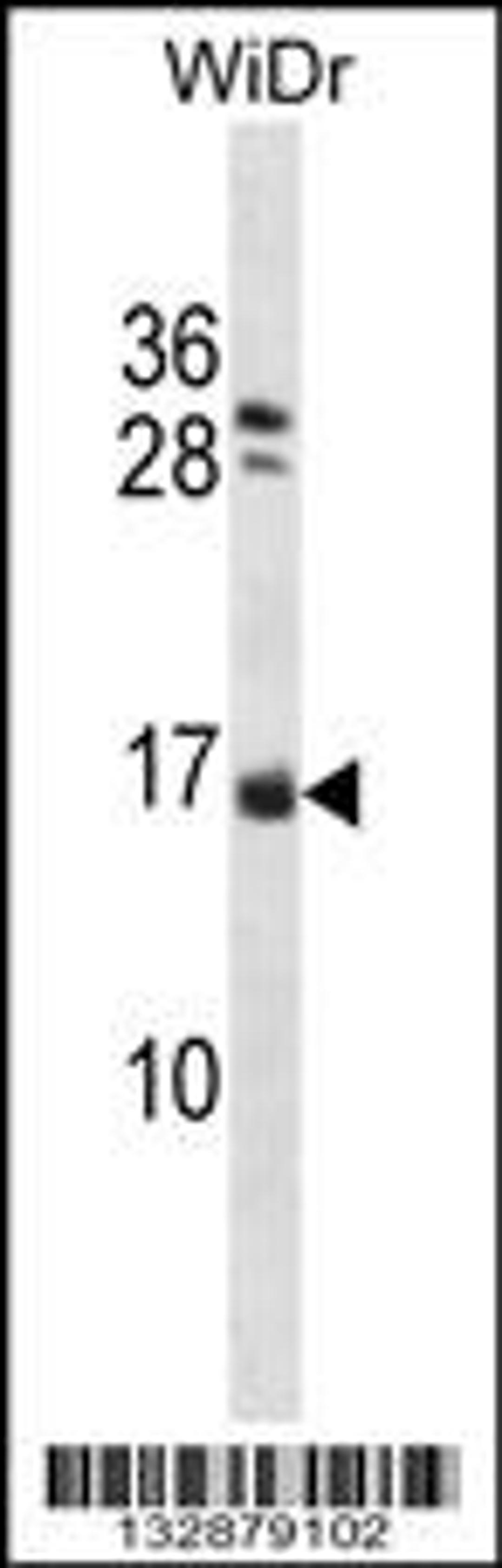 Western blot analysis in WiDr cell line lysates (35ug/lane).