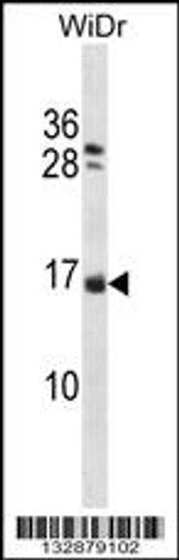 Western blot analysis in WiDr cell line lysates (35ug/lane).