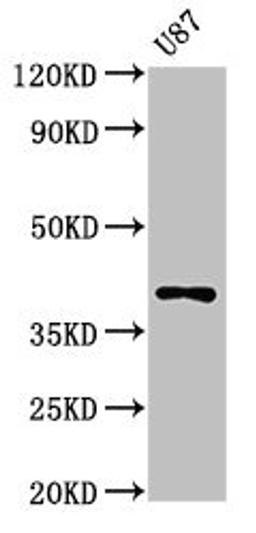 Western Blot. Positive WB detected in: U87 whole cell lysate. All lanes: OPN1SW antibody at 3ug/ml. Secondary. Goat polyclonal to rabbit IgG at 1/50000 dilution. Predicted band size: 40 kDa. Observed band size: 40 kDa.