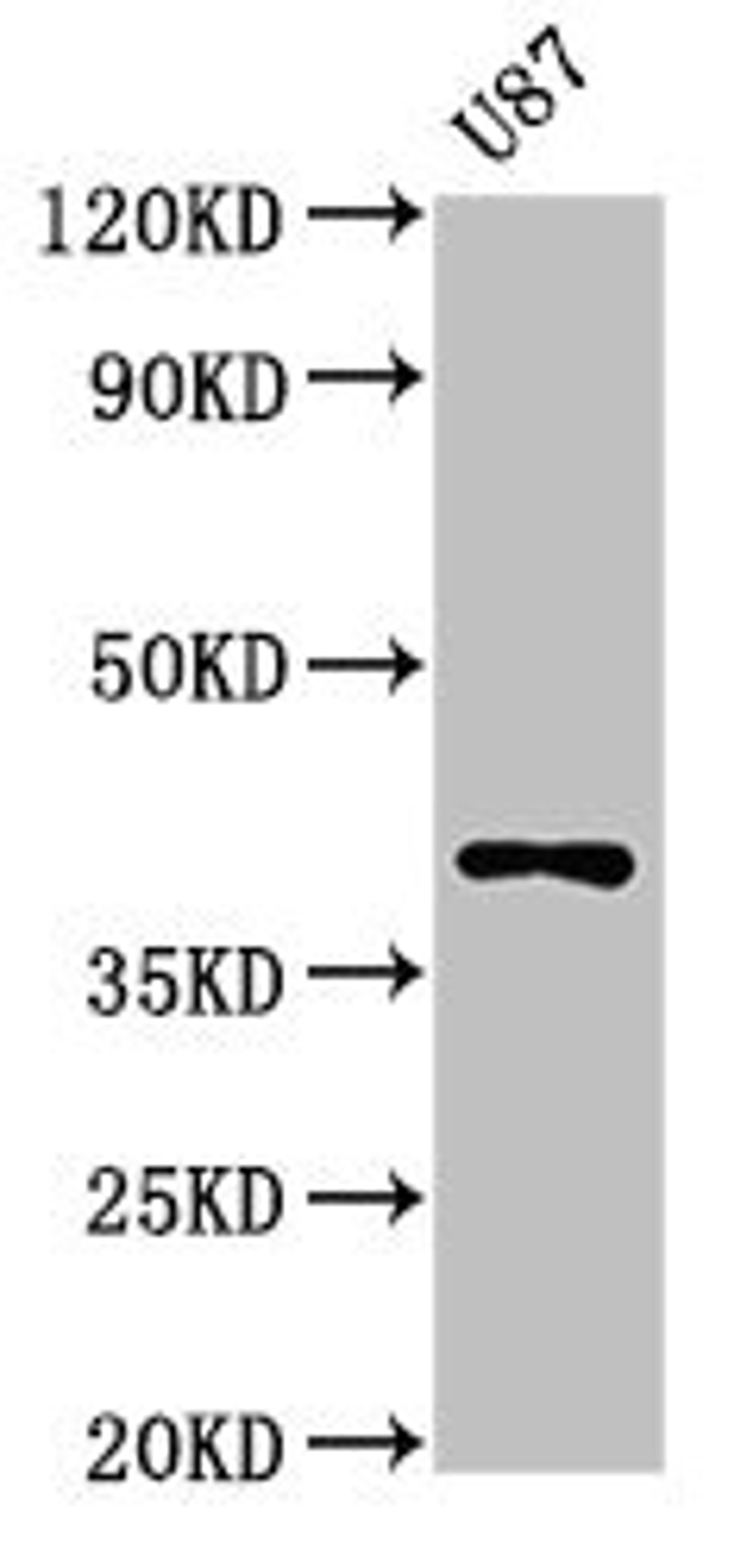 Western Blot. Positive WB detected in: U87 whole cell lysate. All lanes: OPN1SW antibody at 3ug/ml. Secondary. Goat polyclonal to rabbit IgG at 1/50000 dilution. Predicted band size: 40 kDa. Observed band size: 40 kDa.