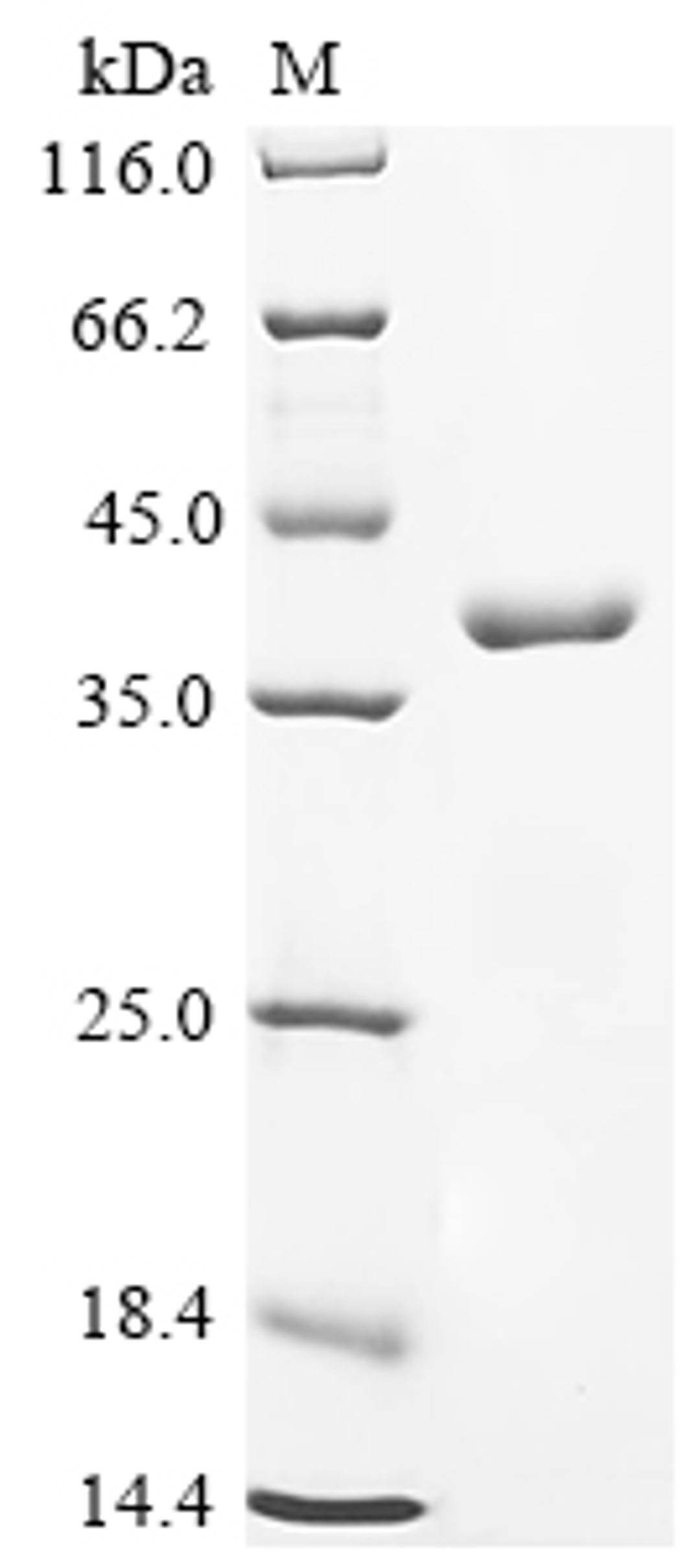 (Tris-Glycine gel) Discontinuous SDS-PAGE (reduced) with 5% enrichment gel and 15% separation gel.