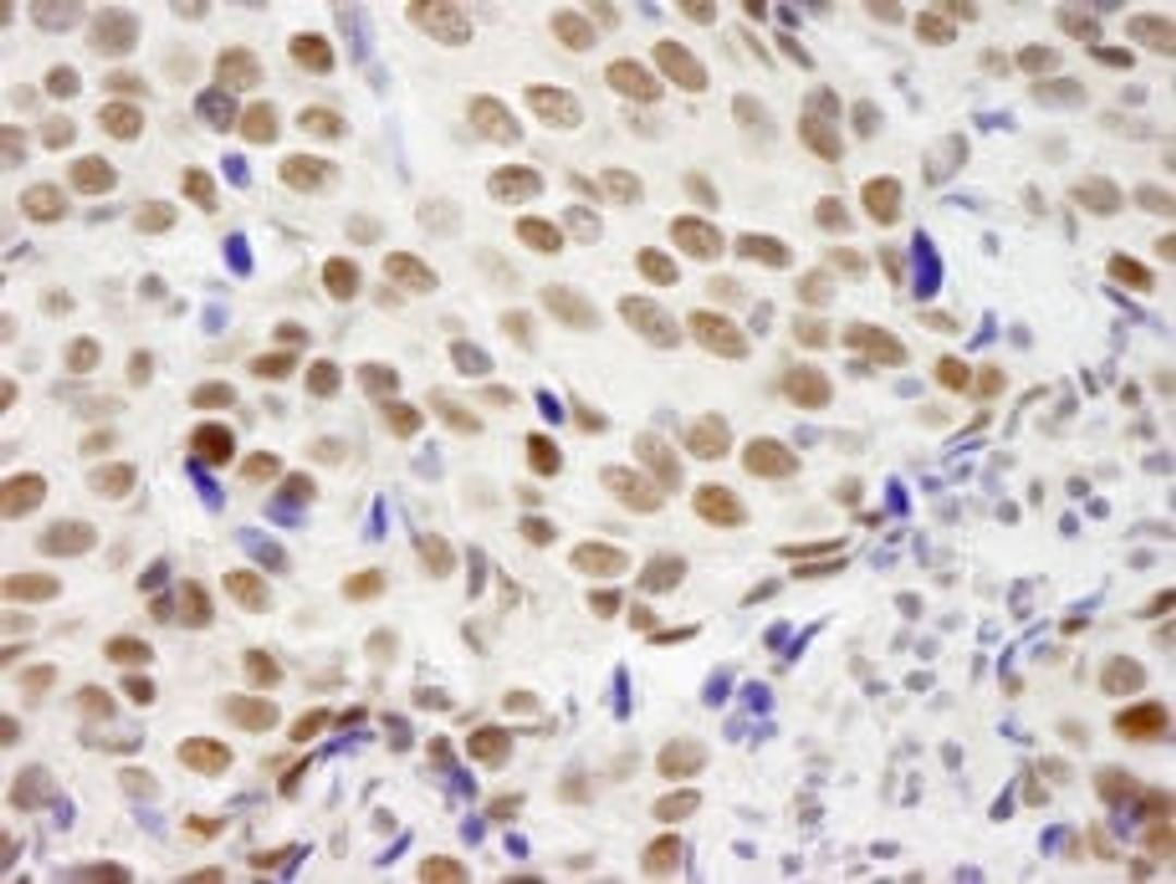 Detection of human ZNF261 by immunohistochemistry.