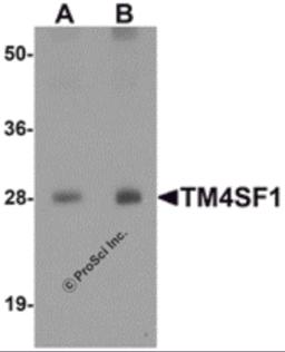 Western blot analysis of TM4SF1 in human lung tissue lysate with TM4SF1 antibody at (A) 0.5 and (B) 1 &#956;g/mL.