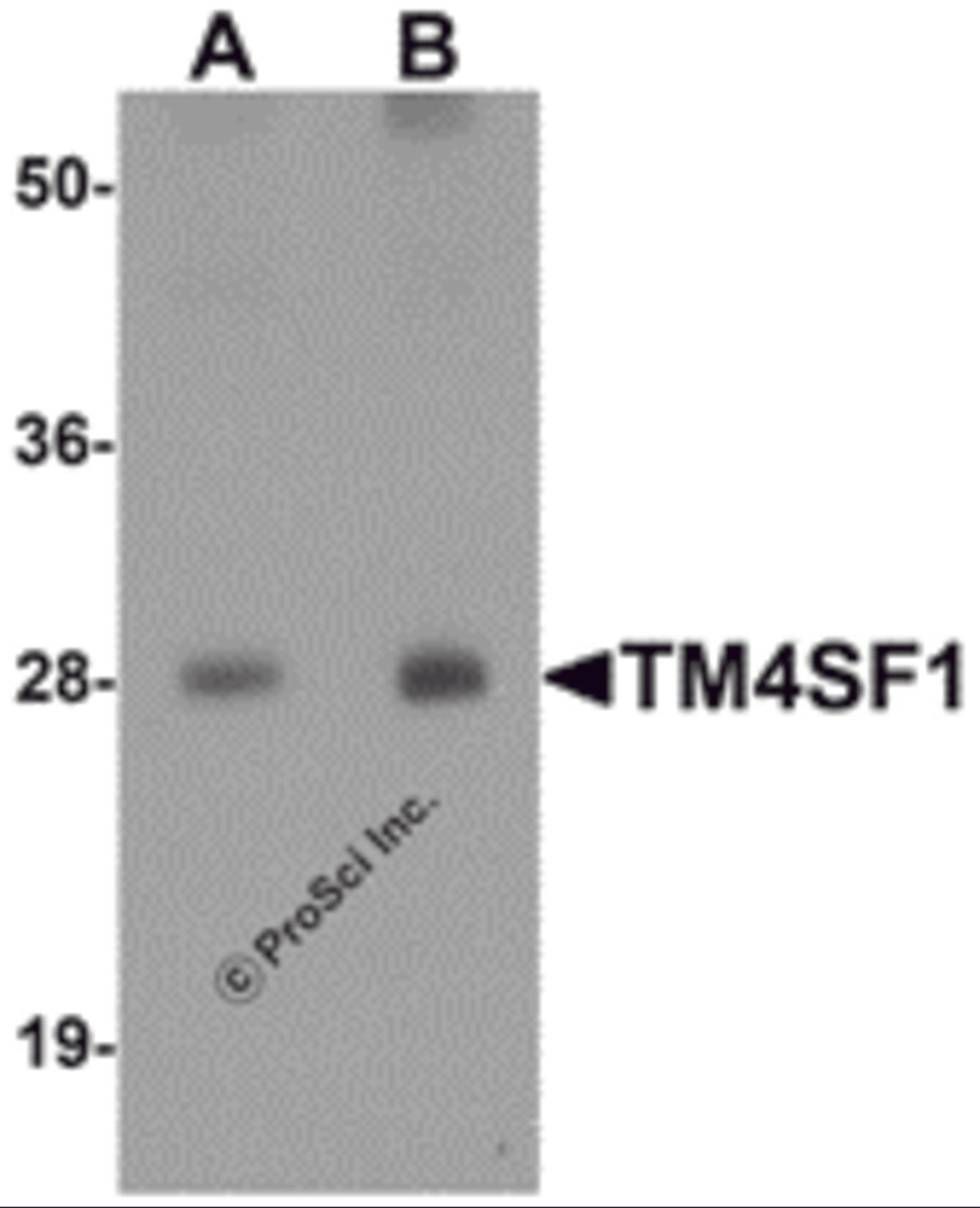 Western blot analysis of TM4SF1 in human lung tissue lysate with TM4SF1 antibody at (A) 0.5 and (B) 1 &#956;g/mL.