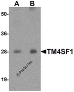 Western blot analysis of TM4SF1 in human lung tissue lysate with TM4SF1 antibody at (A) 0.5 and (B) 1 μg/mL.
