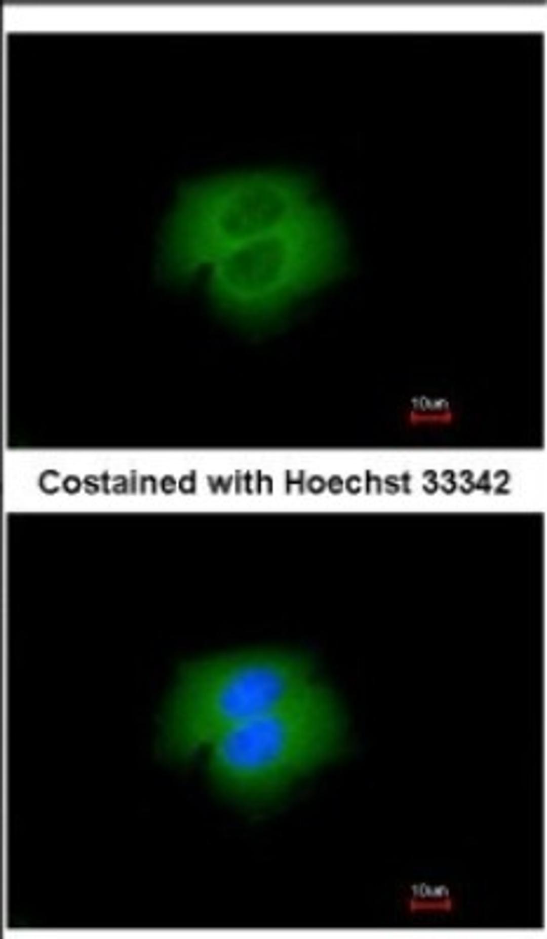 Immunocytochemistry/Immunofluorescence: Calpain 2 Antibody [NBP2-15675] - Immunofluorescence analysis of paraformaldehyde-fixed A431, using antibody at 1:200 dilution.