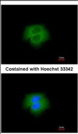 Immunocytochemistry/Immunofluorescence: Calpain 2 Antibody [NBP2-15675] - Immunofluorescence analysis of paraformaldehyde-fixed A431, using antibody at 1:200 dilution.