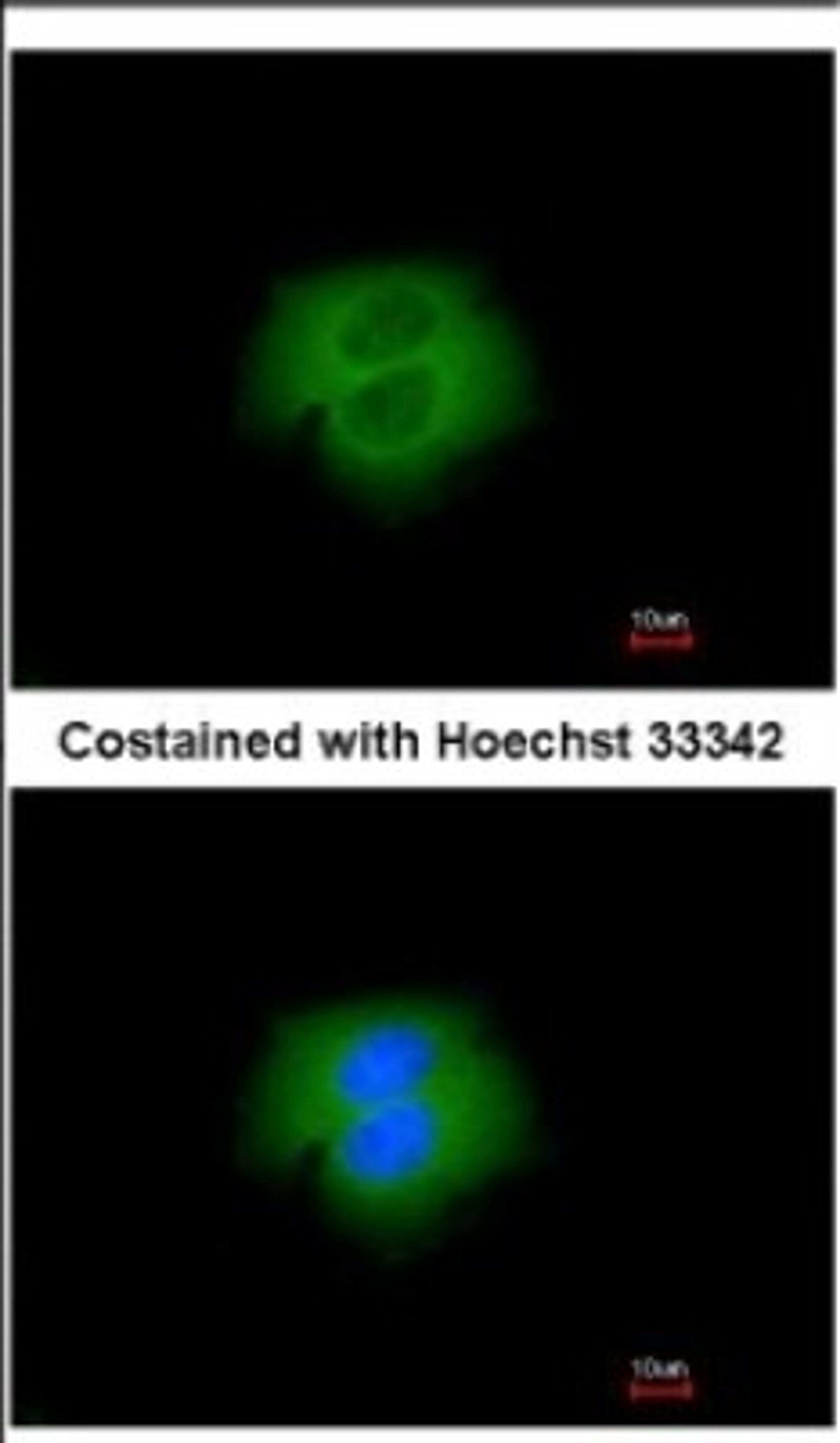 Immunocytochemistry/Immunofluorescence: Calpain 2 Antibody [NBP2-15675] - Immunofluorescence analysis of paraformaldehyde-fixed A431, using antibody at 1:200 dilution.