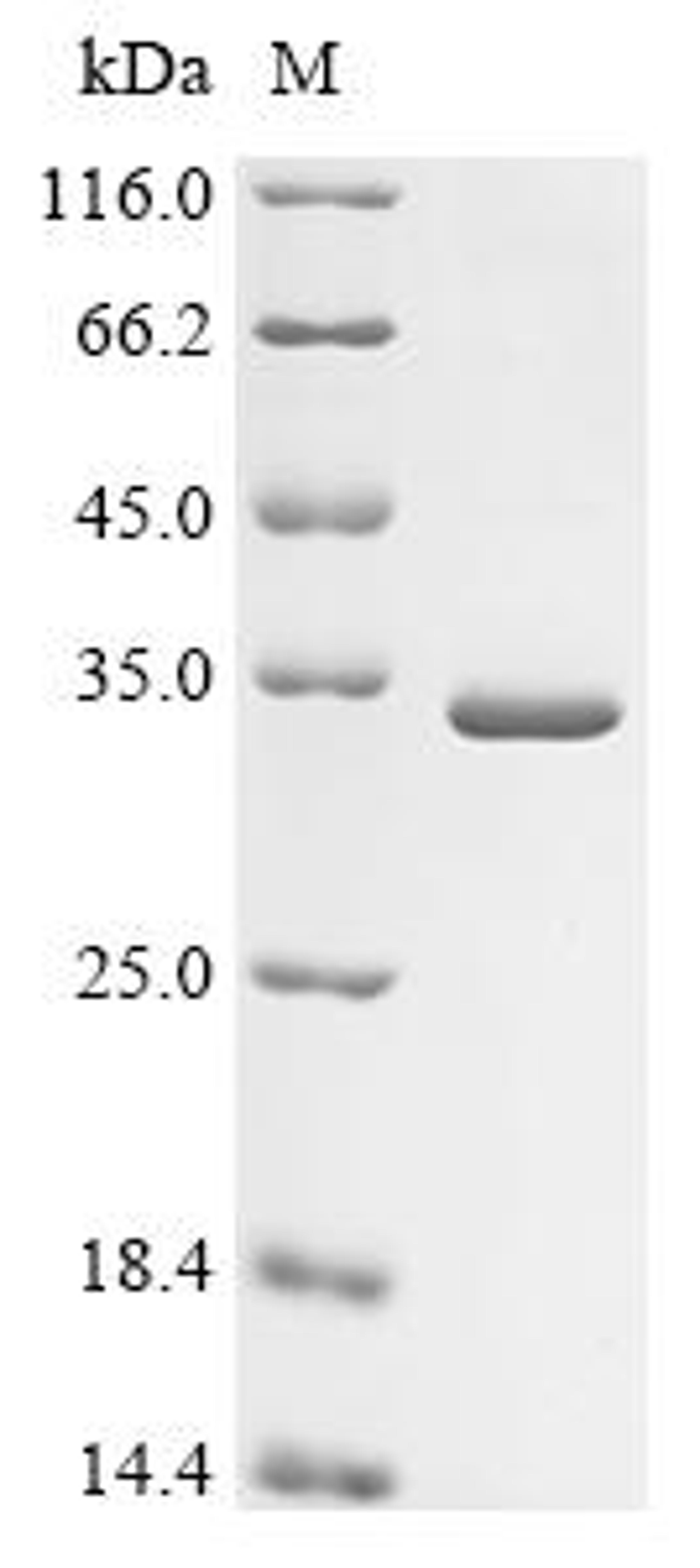 (Tris-Glycine gel) Discontinuous SDS-PAGE (reduced) with 5% enrichment gel and 15% separation gel.