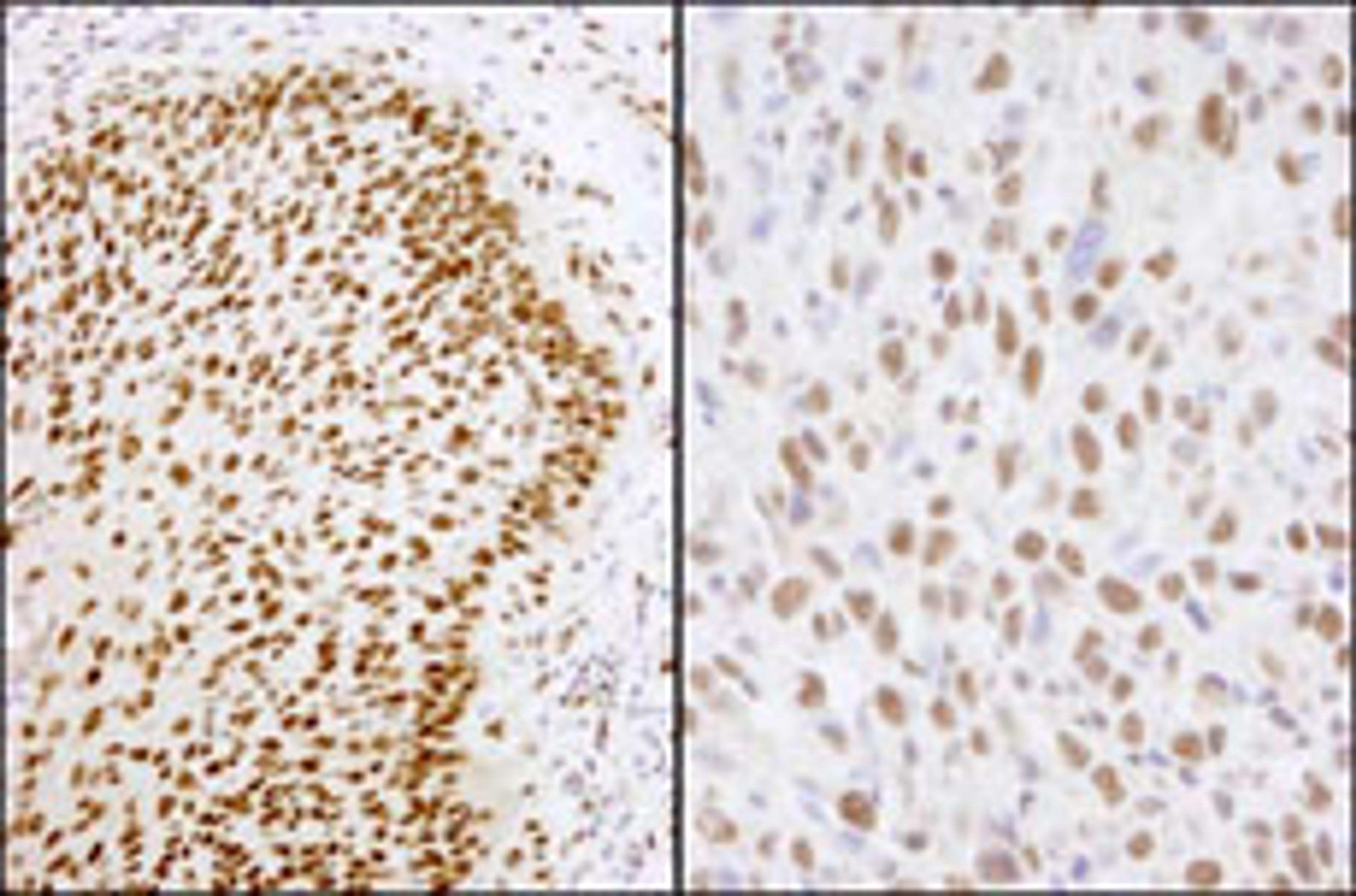 Detection of human and mouse Matrin 3 by immunohistochemistry.