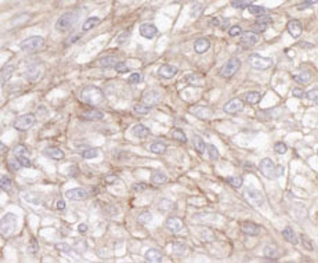 Detection of human IQGAP1 by immunohistochemistry.