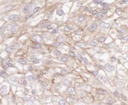 Detection of human IQGAP1 by immunohistochemistry.