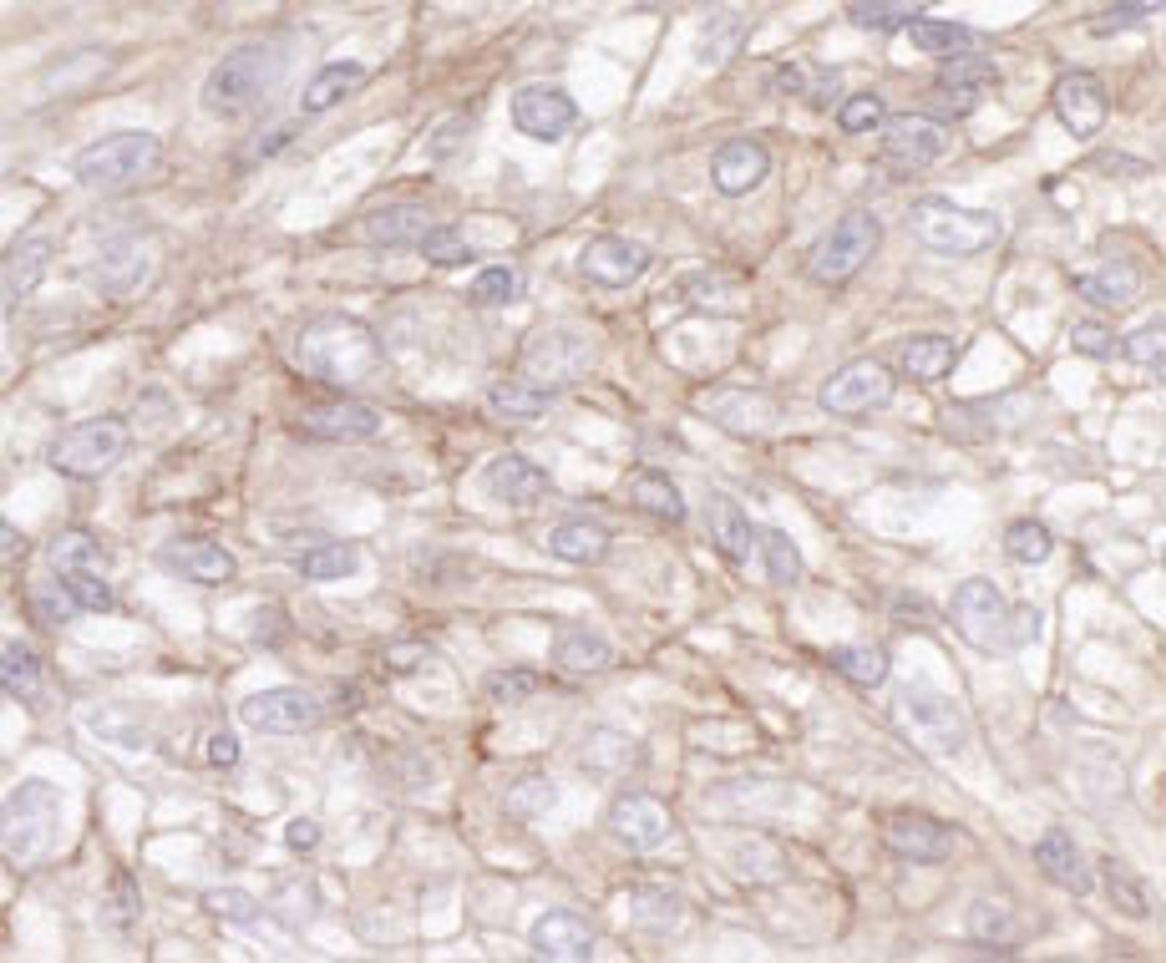 Detection of human IQGAP1 by immunohistochemistry.