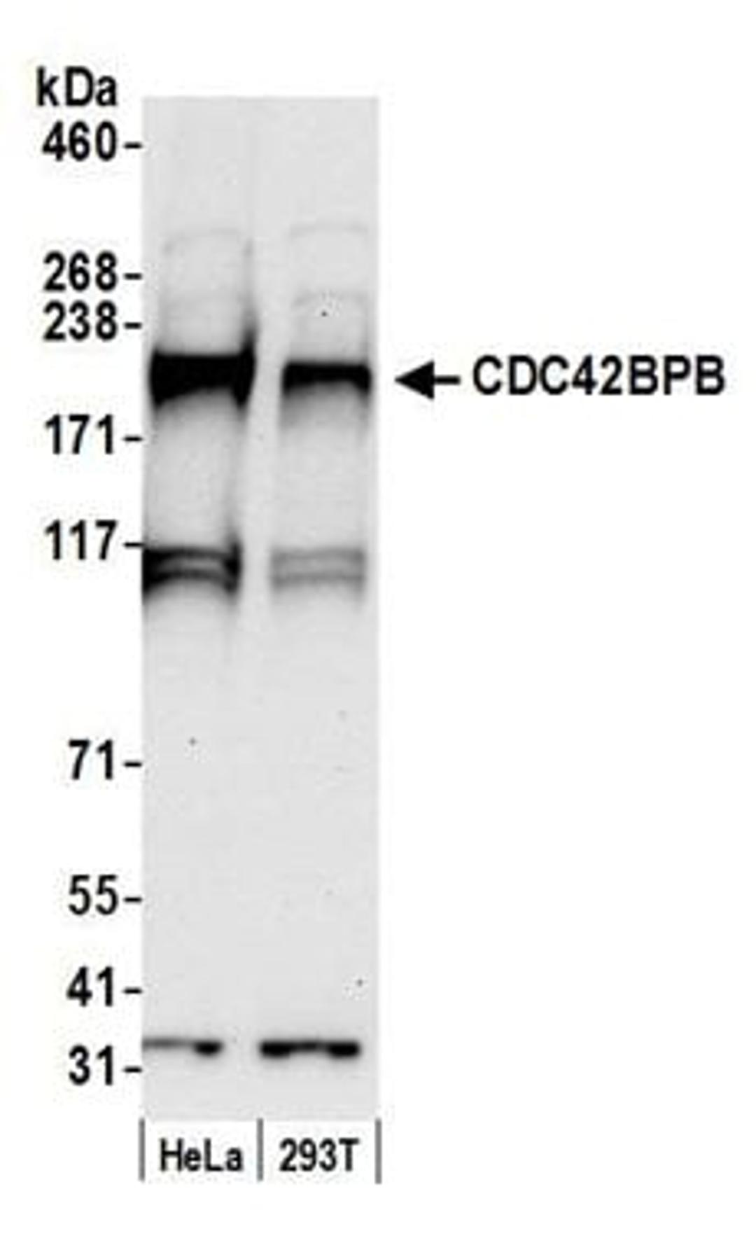 Detection of human CDC42BPB by western blot.