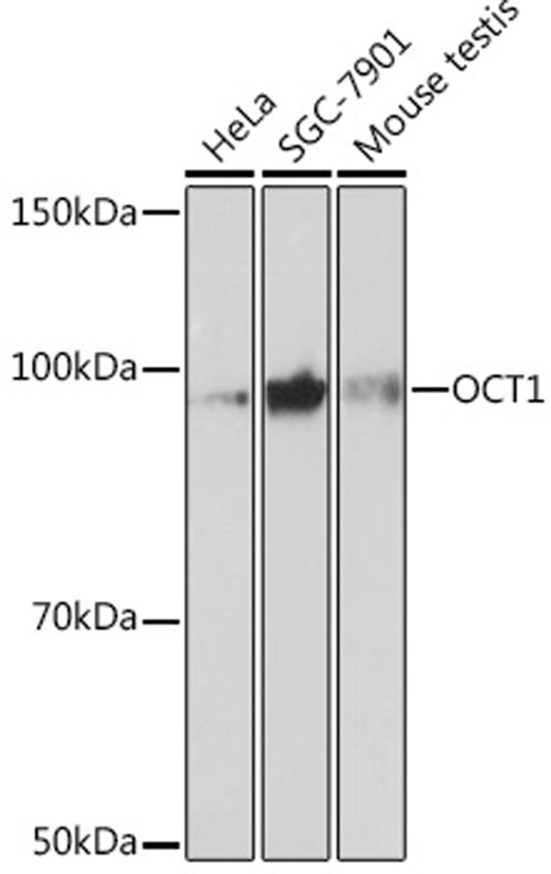 Western blot - OCT1 Rabbit mAb (A3683)