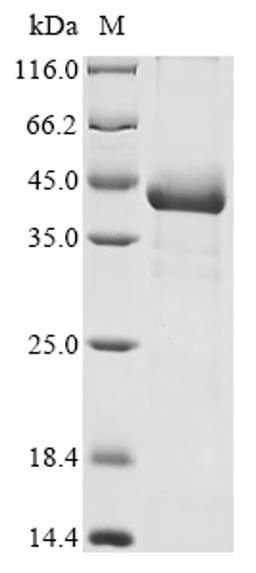 (Tris-Glycine gel) Discontinuous SDS-PAGE (reduced) with 5% enrichment gel and 15% separation gel.
