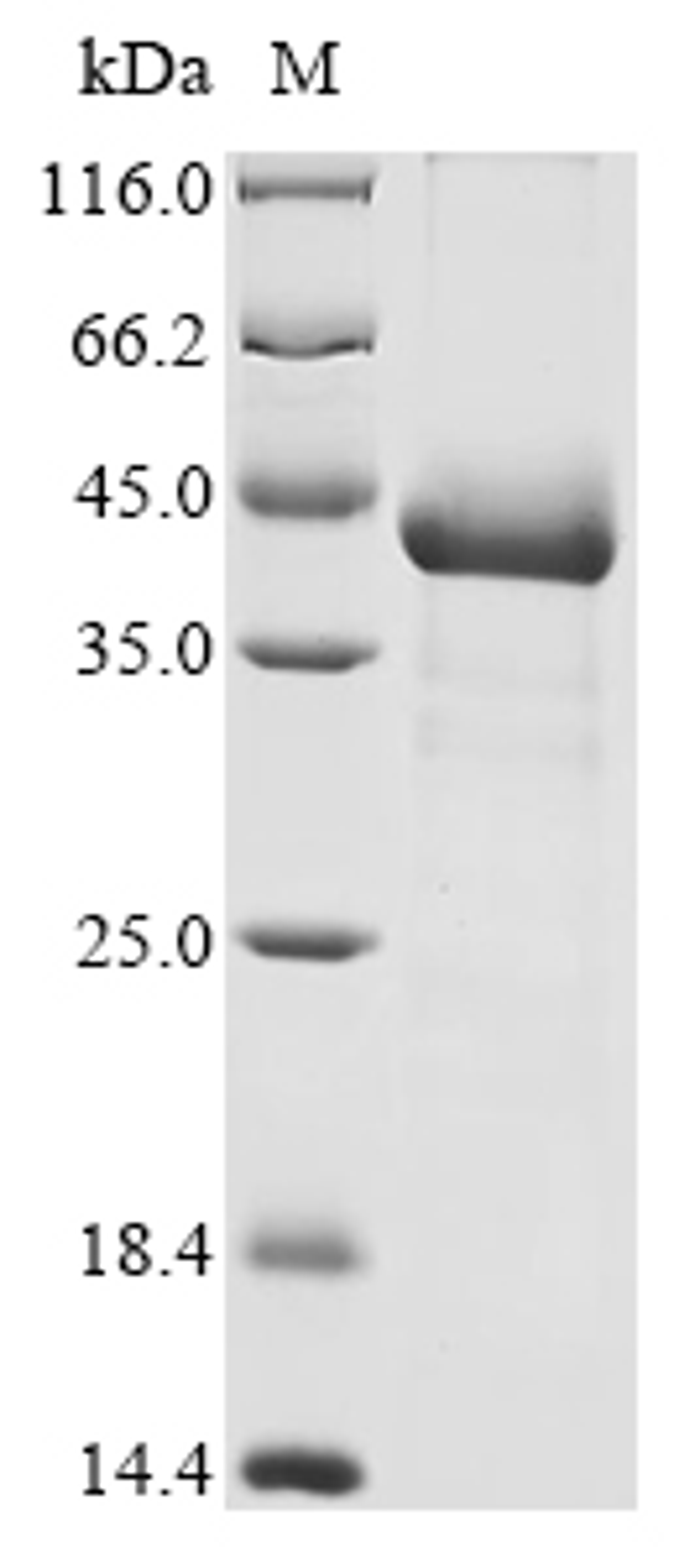 (Tris-Glycine gel) Discontinuous SDS-PAGE (reduced) with 5% enrichment gel and 15% separation gel.