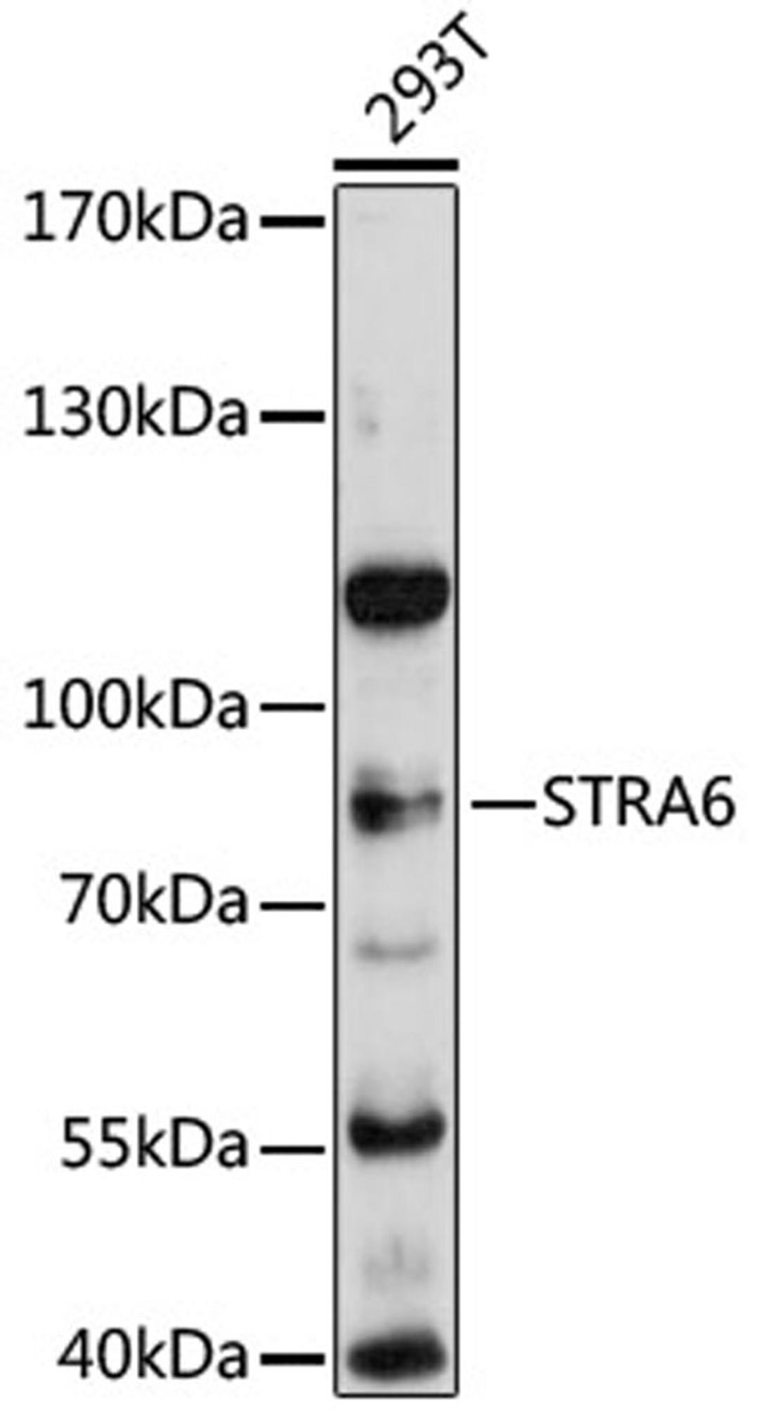 Western blot - STRA6 antibody (A12126)