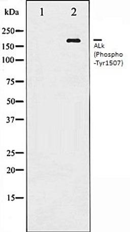 Western blot analysis of COS7 whole cell lysates using ALK (Phospho-Tyr1507) antibody, The lane on the left is treated with the antigen-specific peptide.