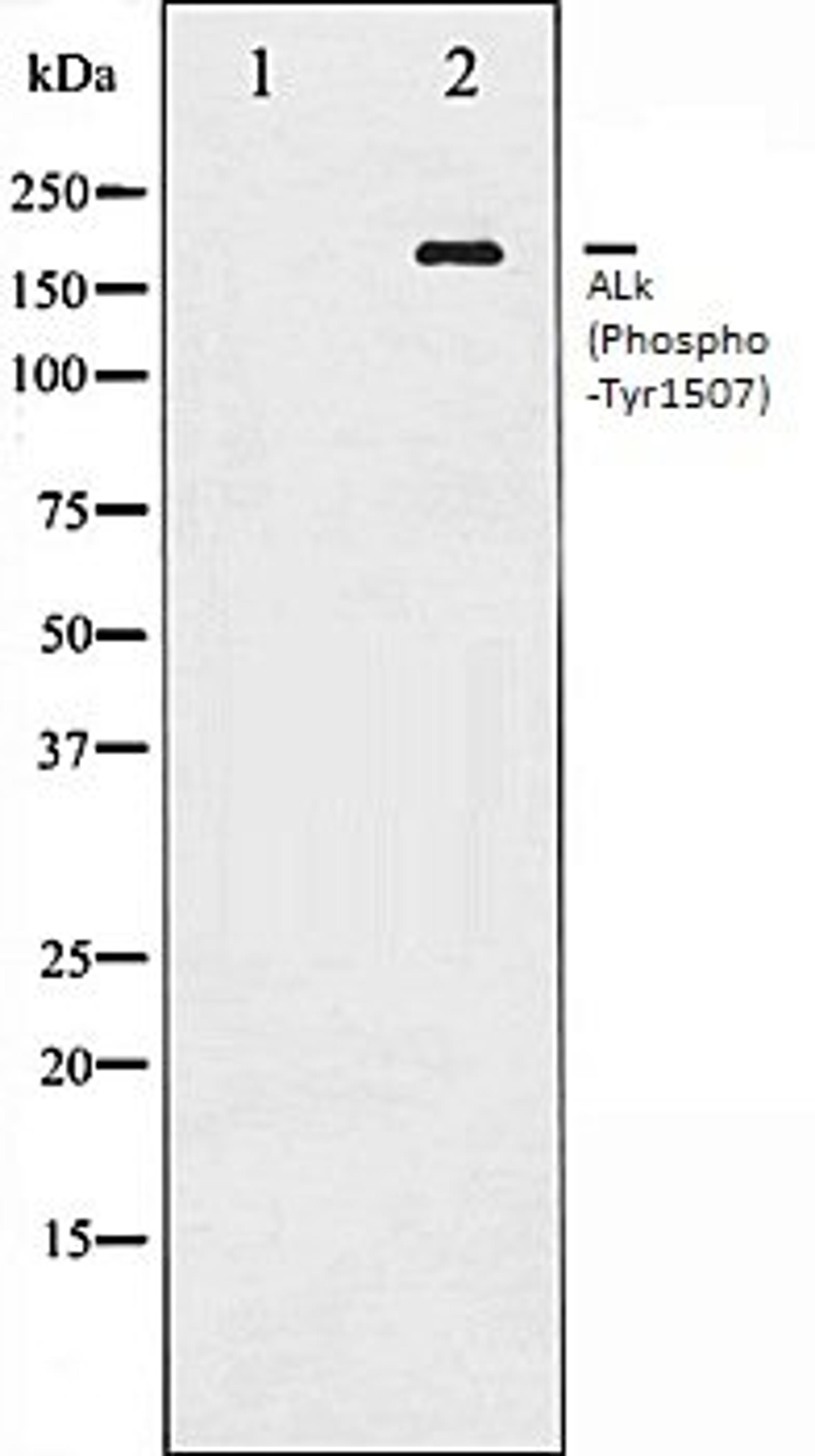 Western blot analysis of COS7 whole cell lysates using ALK (Phospho-Tyr1507) antibody, The lane on the left is treated with the antigen-specific peptide.