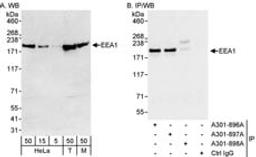 Detection of human and mouse EEA1 by western blot (h&m) and immunoprecipitation (h).