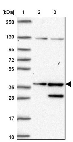 Western Blot: SGTA Antibody [NBP2-47279] - Lane 1: Marker [kDa] 250, 130, 95, 72, 55, 36, 28, 17, 10.  Lane 2: Human cell line RT-4.  Lane 3: Human cell line U-251MG.