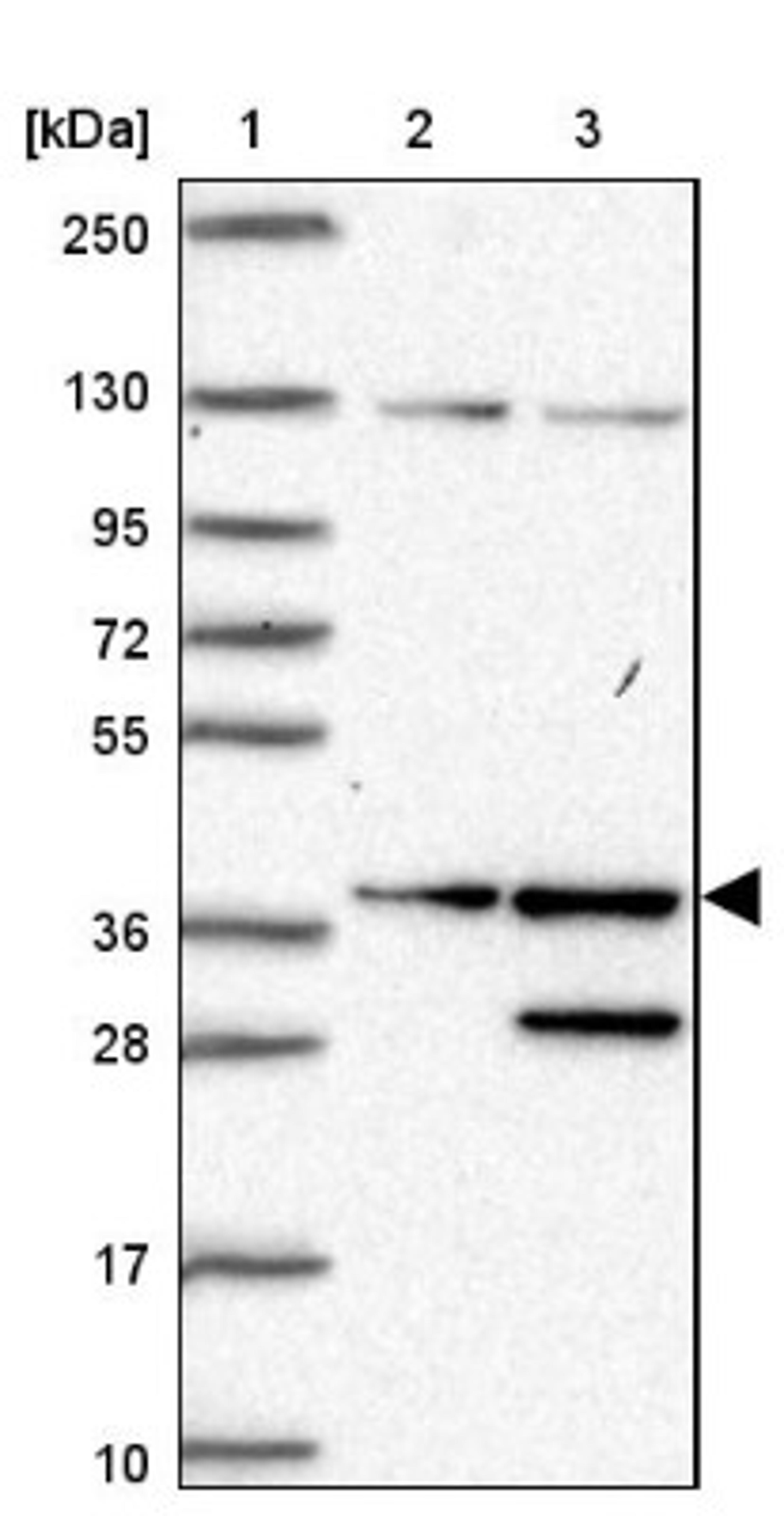 Western Blot: SGTA Antibody [NBP2-47279] - Lane 1: Marker [kDa] 250, 130, 95, 72, 55, 36, 28, 17, 10.  Lane 2: Human cell line RT-4.  Lane 3: Human cell line U-251MG.