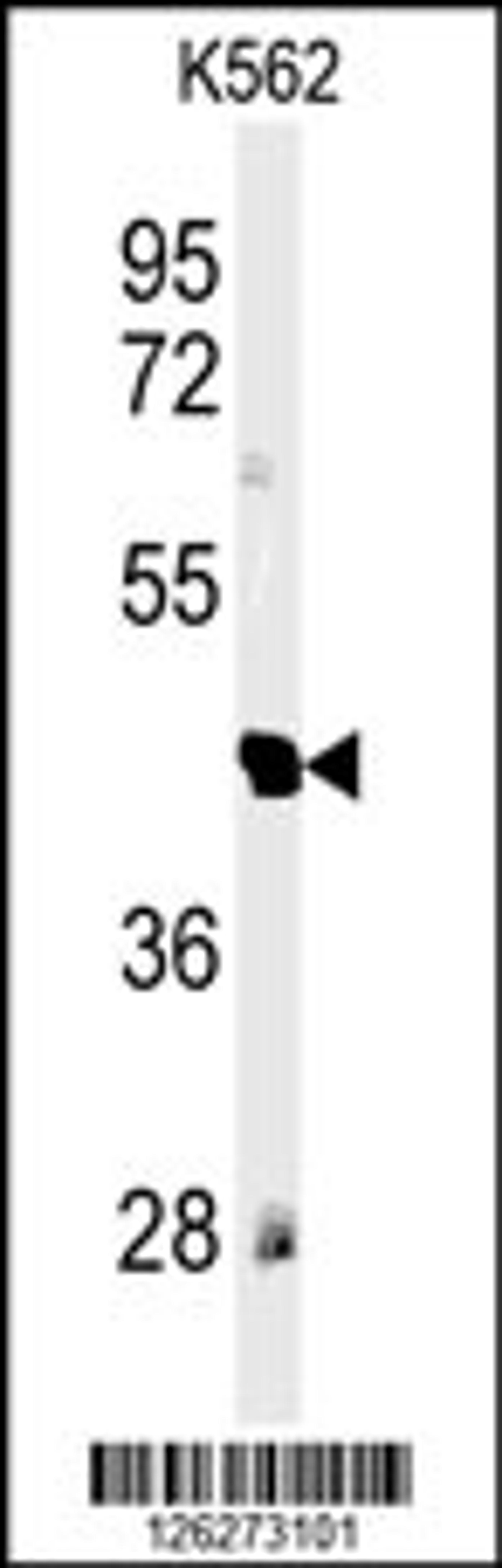 Western blot analysis of RTN4RL1 Antibody in K562 cell line lysates (35ug/lane)