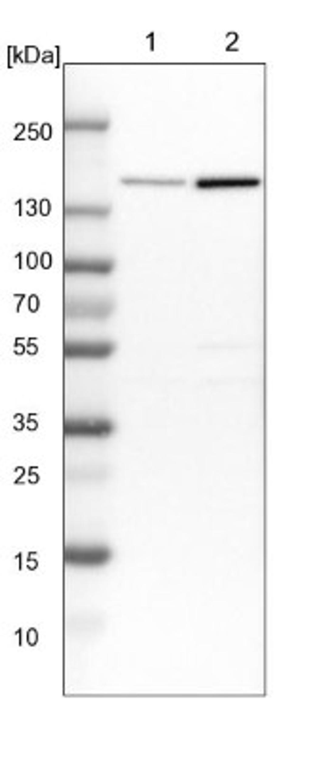 Western Blot: PURL Antibody [NBP1-84691] - Lane 1: NIH-3T3 cell lysate (Mouse embryonic fibroblast cells)<br/>Lane 2: NBT-II cell lysate (Rat Wistar bladder tumour cells)